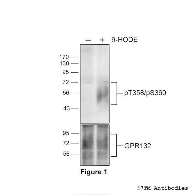 Phospho-GPR132 (Thr358, Ser360) Antibody in Western Blot (WB)