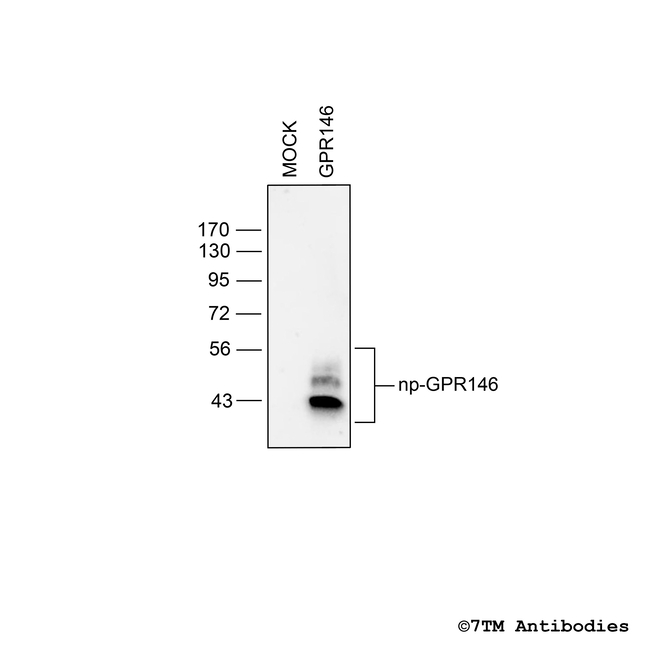 GPR146, G protein-coupled Receptor 146 Antibody in Western Blot (WB)