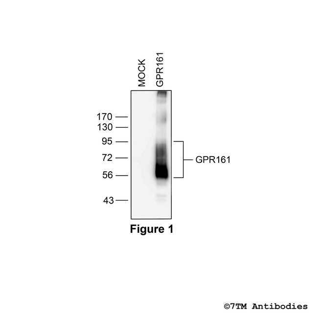 GPR161, G protein-coupled Receptor 161 Antibody in Western Blot (WB)