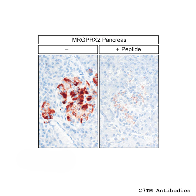 MRGPRX2, MRGPRX2 Mas-related Receptor Antibody in Immunohistochemistry (Paraffin) (IHC (P))