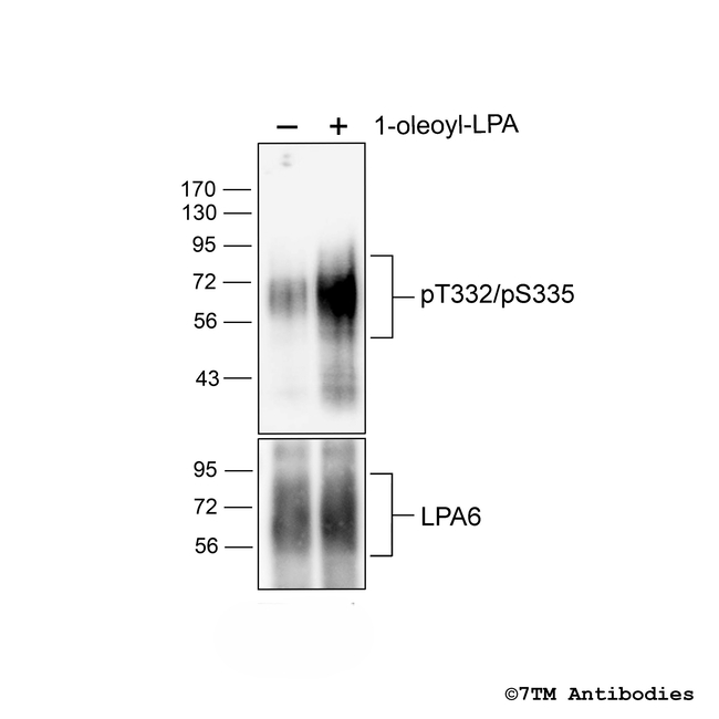 Phospho-Lysophosphatidic Acid Receptor 6 (Thr332, Ser335) Antibody in Western Blot (WB)