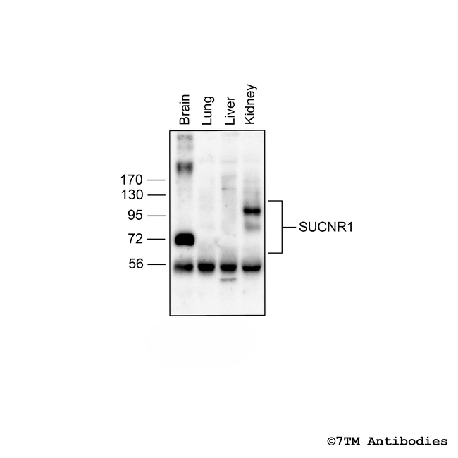 SUCNR1/GPR91, Succinate Receptor Antibody in Western Blot (WB)