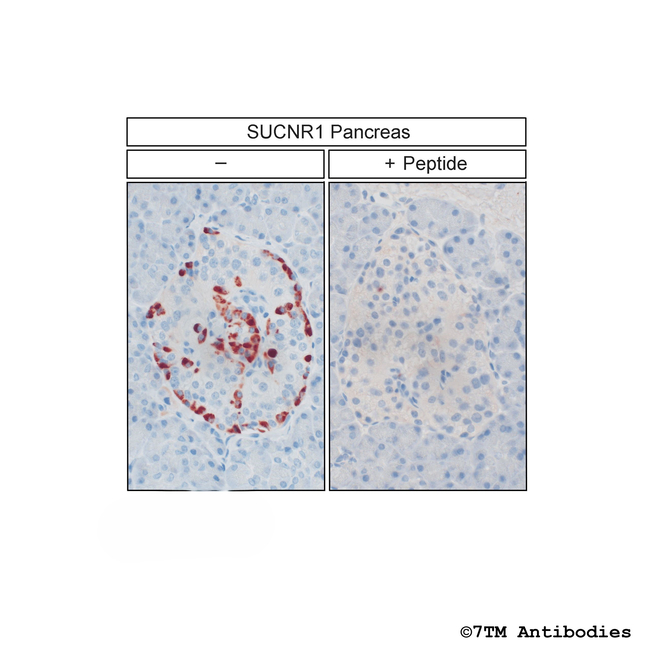 SUCNR1/GPR91, Succinate Receptor Antibody in Immunohistochemistry (Paraffin) (IHC (P))