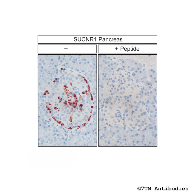 SUCNR1/GPR91, Succinate Receptor Antibody in Immunohistochemistry (Paraffin) (IHC (P))