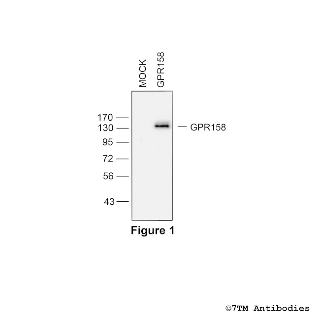 GPR158/mGlyR, G protein-coupled Receptor 158 Antibody in Western Blot (WB)