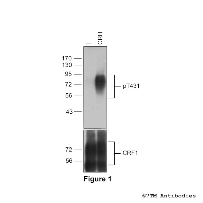 Phospho-Corticotropin-Releasing Factor Receptor 1 (Thr431) Antibody in Western Blot (WB)