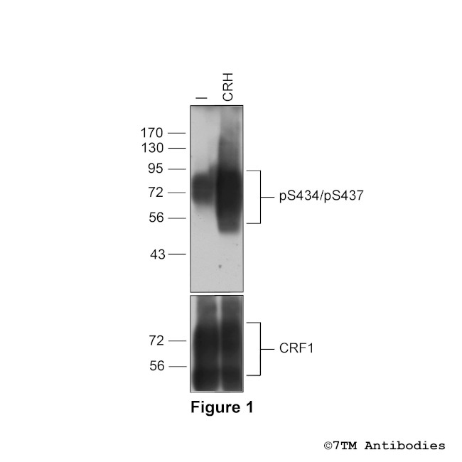 Phospho-Corticotropin-Releasing Factor Receptor 1 (Ser434, Ser437) Antibody in Western Blot (WB)