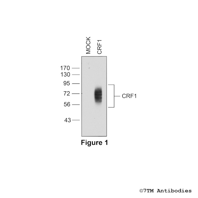 CRF1 (Corticotropin-Releasing Factor Receptor 1) Antibody in Western Blot (WB)
