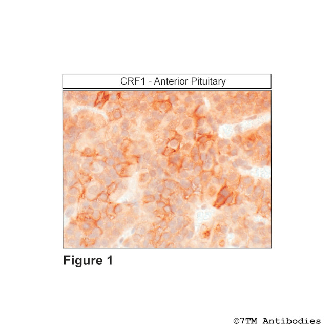 CRF1, Corticotropin-Releasing Factor Receptor 1 Antibody in Immunohistochemistry (Paraffin) (IHC (P))