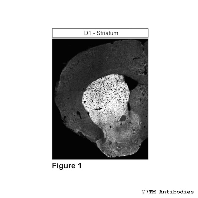 D1, Dopamine Receptor 1 Antibody in Immunohistochemistry (PFA fixed) (IHC (PFA))