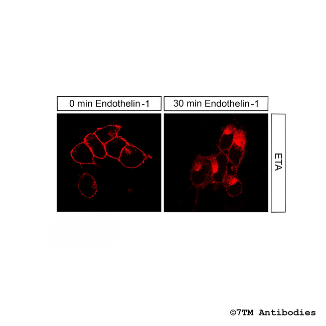 ETA (Endothelin Receptor A) Antibody in Immunocytochemistry (ICC/IF)