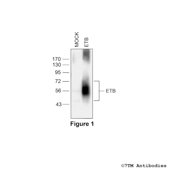 ETB (Endothelin Receptor B) Antibody in Western Blot (WB)