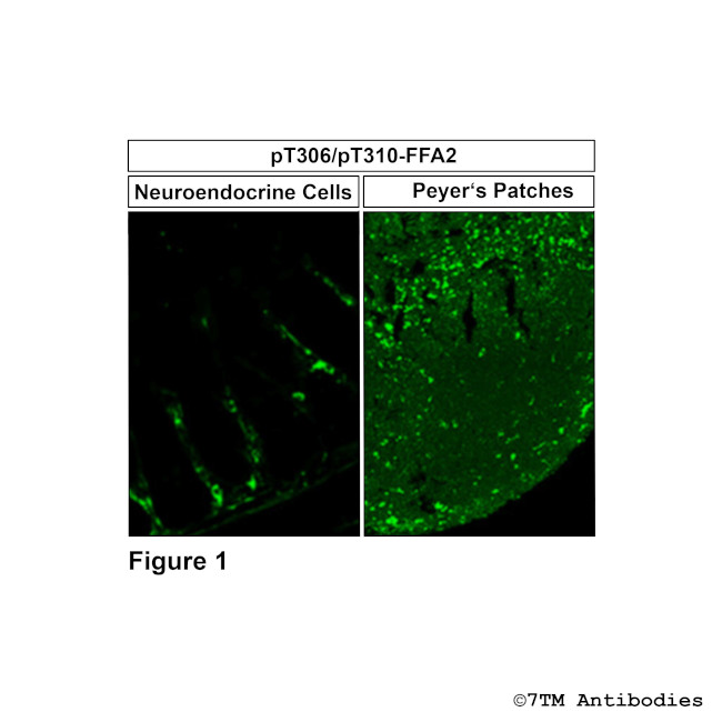 Phospho-FFA2 (Thr306, Thr310) Antibody in Immunohistochemistry (PFA fixed) (IHC (PFA))
