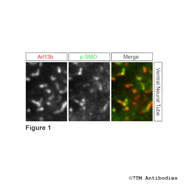 Phospho-SMO Receptor (Ser594, Thr597, Ser599) Antibody in Immunohistochemistry (PFA fixed) (IHC (PFA))