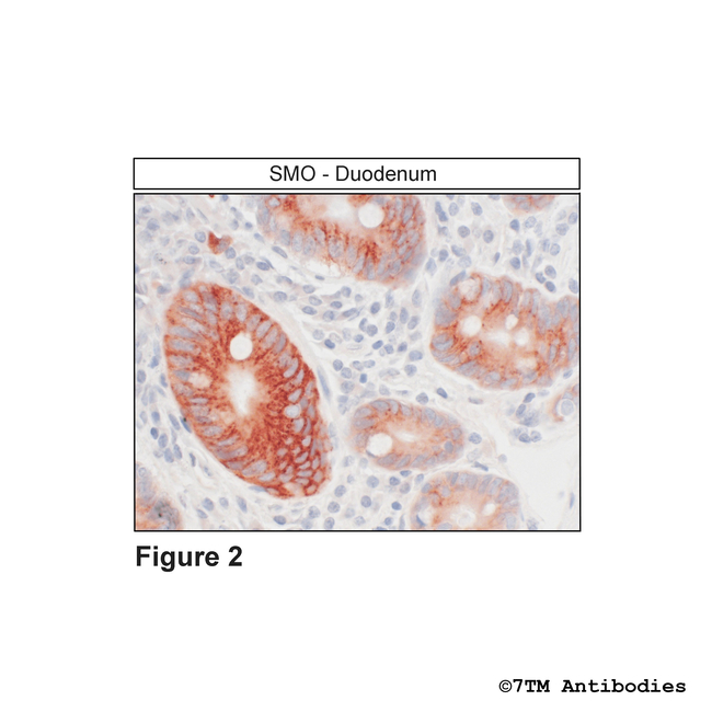 SMO, Smoothened Receptor Antibody in Immunohistochemistry (Paraffin) (IHC (P))