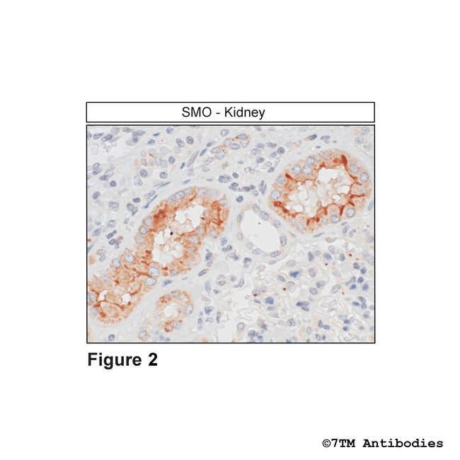 SMO, Smoothened Receptor Antibody in Immunohistochemistry (Paraffin) (IHC (P))