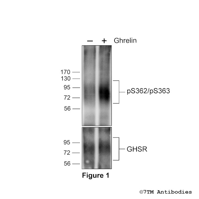Phospho-Ghrelin Receptor (Ser362, Ser363) Antibody in Western Blot (WB)
