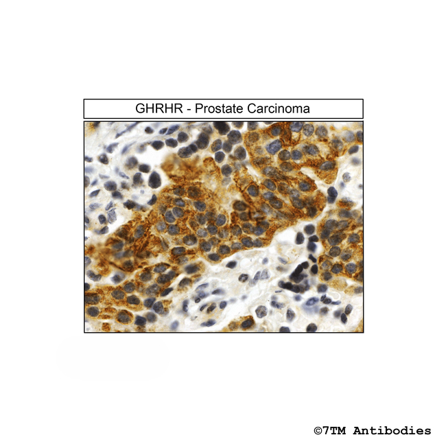 GHRHR (GHRH Receptor) Antibody in Immunohistochemistry (Paraffin) (IHC (P))