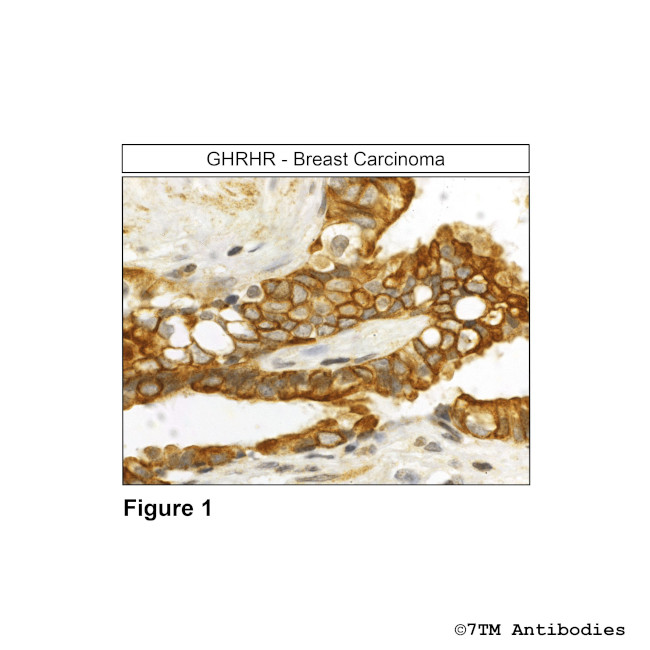 GHRHR, GHRH Receptor Antibody in Immunohistochemistry (Paraffin) (IHC (P))