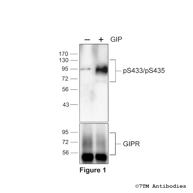 Phospho-Gastric Inhibitory Polypeptide Receptor (Ser433, Ser435) Antibody in Western Blot (WB)