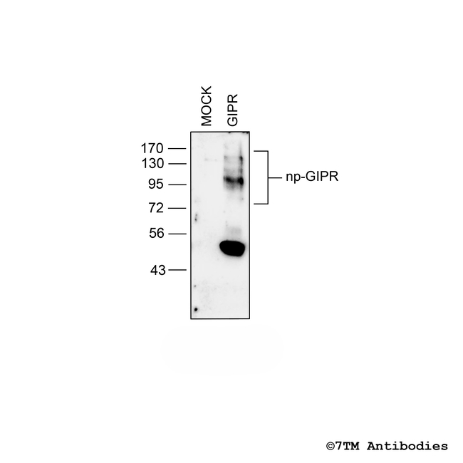 GIPR Gastric Inhibitory Polypeptide Receptor Antibody in Western Blot (WB)