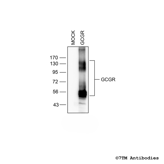 GCGR Glucagon Receptor Antibody in Western Blot (WB)