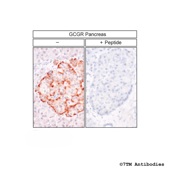GCGR, Glucagon Receptor Antibody in Immunohistochemistry (Paraffin) (IHC (P))
