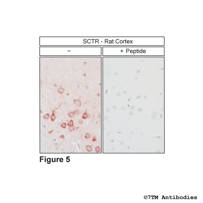 SCTR, Secretin Receptor Antibody in Immunohistochemistry (Paraffin) (IHC (P))