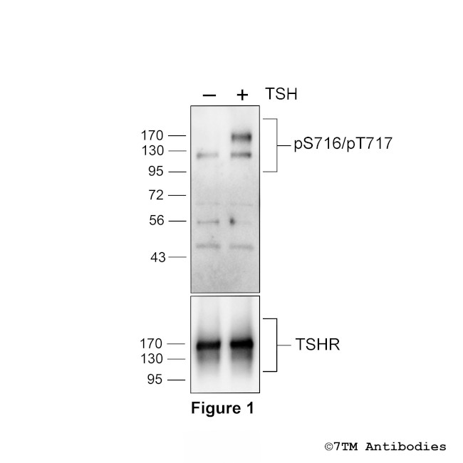 Phospho-Thyrotropin Receptor (Ser716, Thr717) Antibody in Western Blot (WB)
