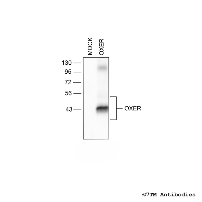 OXER, Oxoeicosanoid Receptor Antibody in Western Blot (WB)
