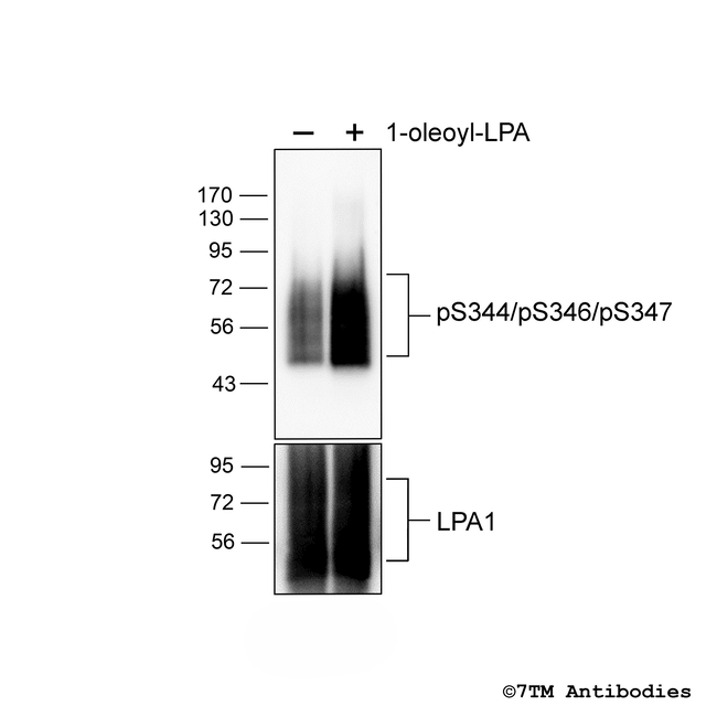 Phospho-Lysophosphatidic Acid Receptor 1 (Ser344, Ser346, Ser347) Antibody in Western Blot (WB)