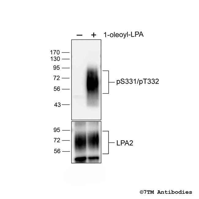 Phospho-Lysophosphatidic Acid Receptor 2 (Ser331, Thr332) Antibody in Western Blot (WB)