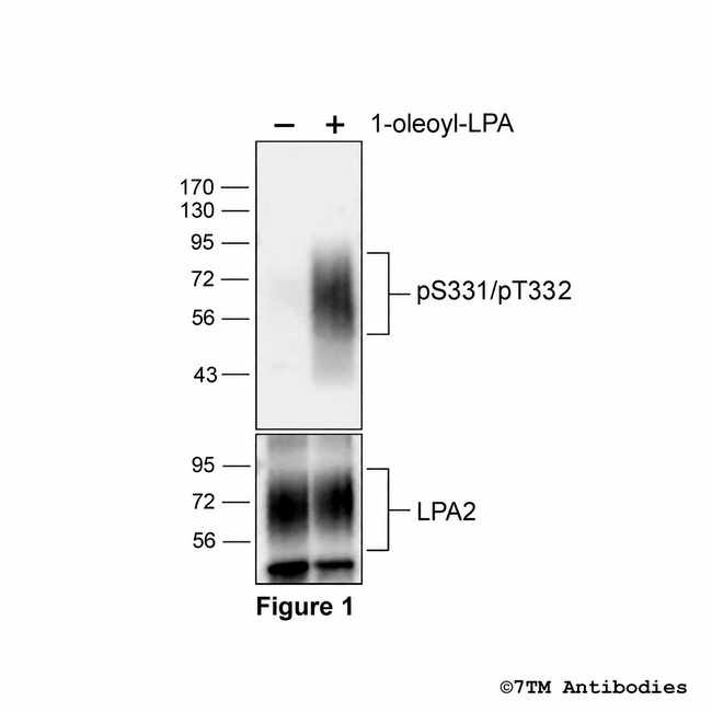Phospho-Lysophosphatidic Acid Receptor 2 (Ser331, Thr332) Antibody in Western Blot (WB)
