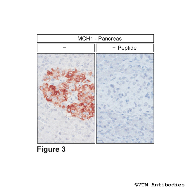 MCH1, Melanin-Concentrating Hormone Receptor 1 Antibody in Immunohistochemistry (Paraffin) (IHC (P))