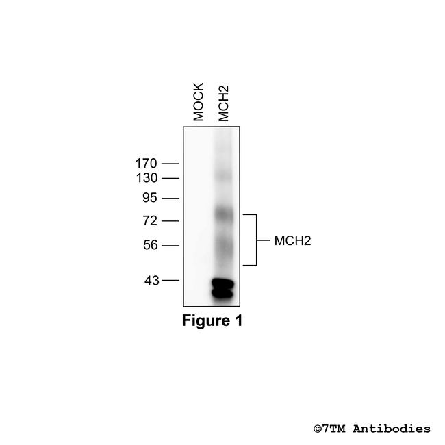MCH2, Melanin-Concentrating Hormone Receptor 2 Antibody in Western Blot (WB)