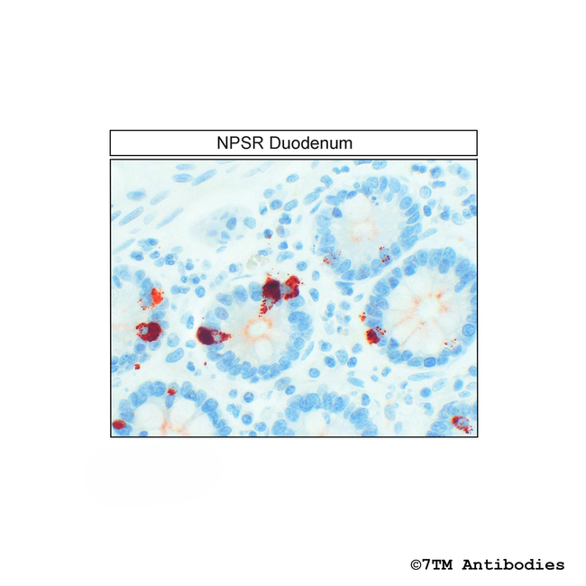NPSR, Neuropeptide S Receptor Antibody in Immunohistochemistry (Paraffin) (IHC (P))