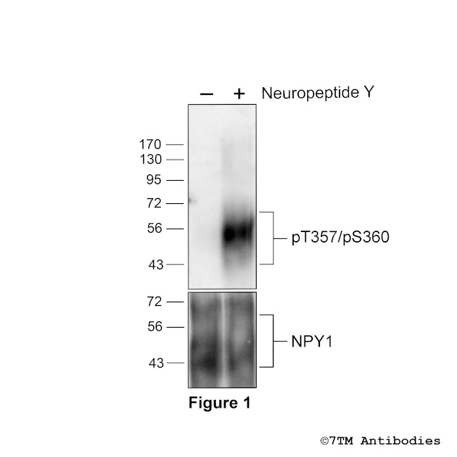 Phospho-Neuropeptide Y Receptor 1 (Thr357, Ser360) Antibody in Western Blot (WB)