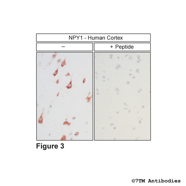 NPY1, Neuropeptide Y Receptor 1 Antibody in Immunohistochemistry (Paraffin) (IHC (P))