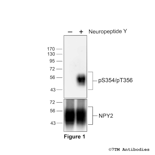 Phospho-Neuropeptide Y Receptor 2 (Ser354, Thr356) Antibody in Western Blot (WB)