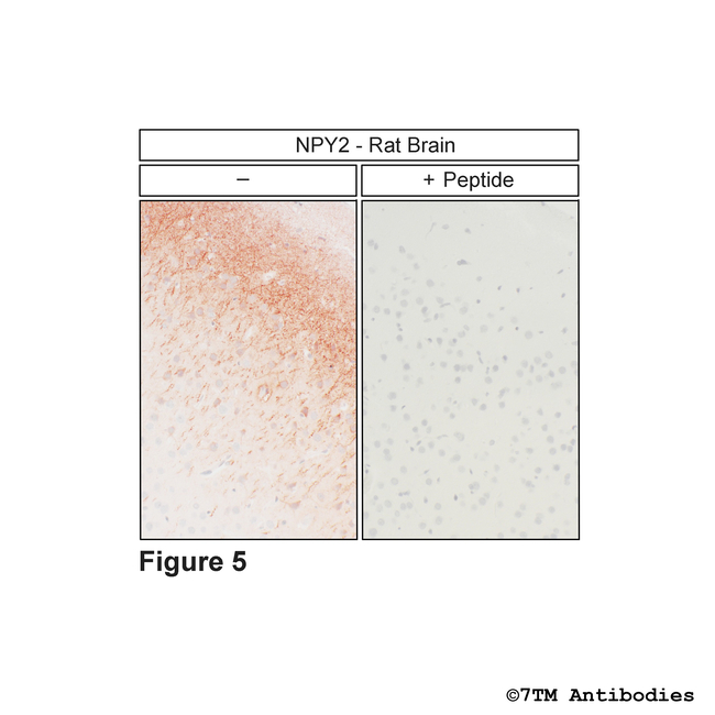 NPY2, Neuropeptide Y Receptor 2 Antibody in Immunohistochemistry (Paraffin) (IHC (P))