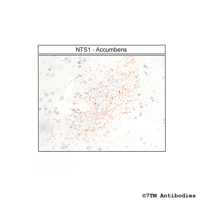 NTS1, Neurotensin Receptor 1 Antibody in Immunohistochemistry (Paraffin) (IHC (P))