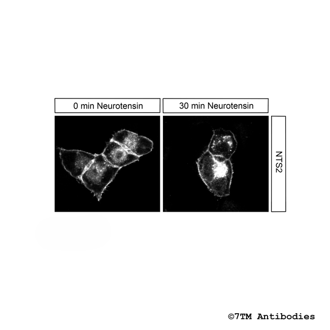 NTS2 (Neurotensin Receptor 2) Antibody in Immunocytochemistry (ICC/IF)