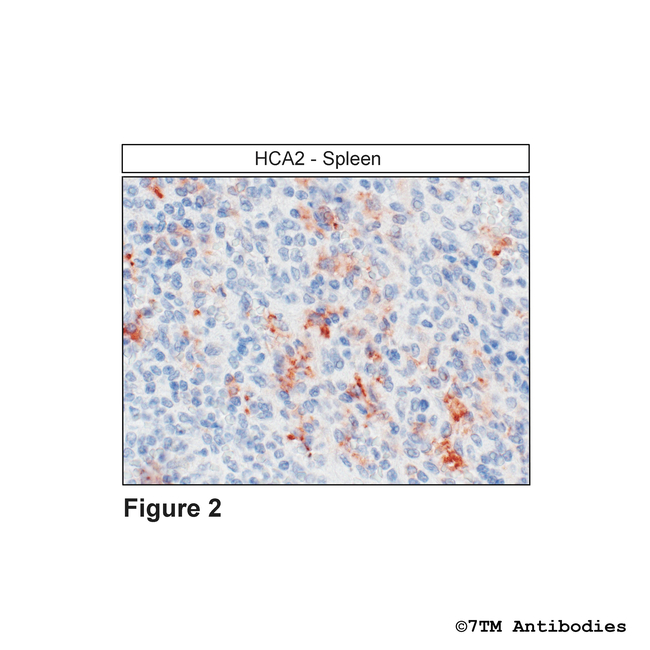 HCA2, Hydroxycarboxylic Acid Receptor 2 Antibody in Immunohistochemistry (Paraffin) (IHC (P))