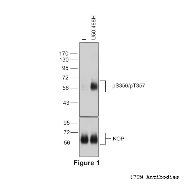 Phospho-kappa-Opioid Receptor (Ser356, Thr357) Antibody in Western Blot (WB)