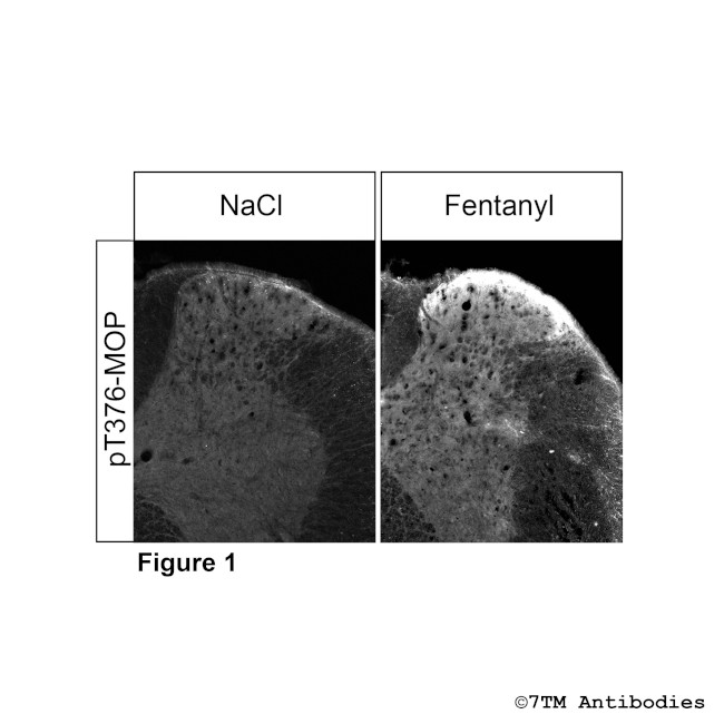 Phospho-mu-Opioid Receptor (Thr376) Antibody in Immunohistochemistry (PFA fixed) (IHC (PFA))