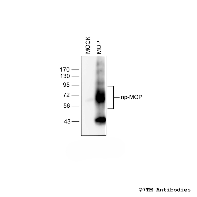 MOP, mu-Opioid Receptor Antibody in Western Blot (WB)