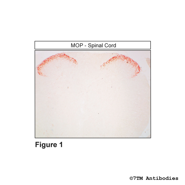 MOP, mu-Opioid Receptor Antibody in Immunohistochemistry (Paraffin) (IHC (P))
