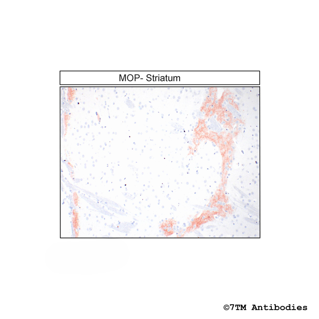 MOP, mu-Opioid Receptor Antibody in Immunohistochemistry (Paraffin) (IHC (P))