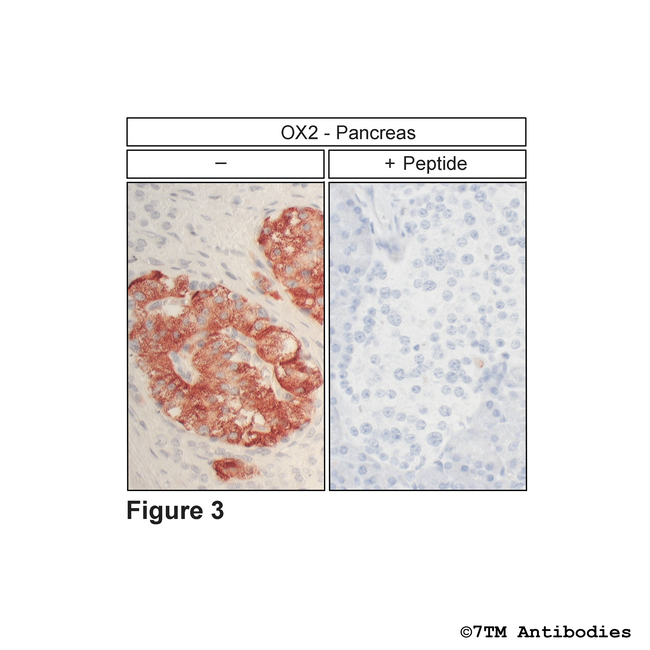 OX2 Orexin Receptor 2 Antibody in Immunohistochemistry (Paraffin) (IHC (P))