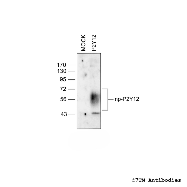 P2Y12 P2Y Purinoceptor 12 Antibody in Western Blot (WB)